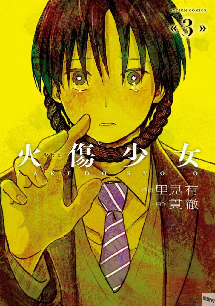 Yakedo Shoujo Chapter 13 - 1